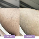 Depilação Suave - Crystal Hair Eraser™